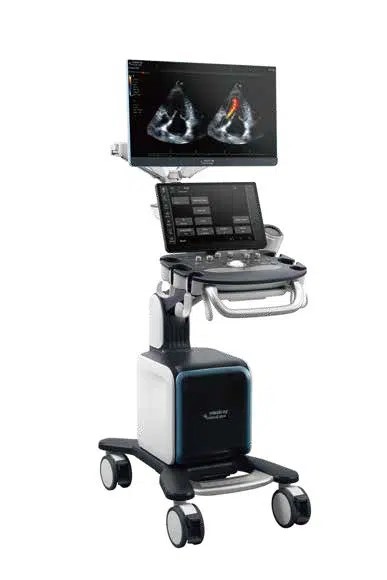 Vetus 80 ultralydsscanner 1